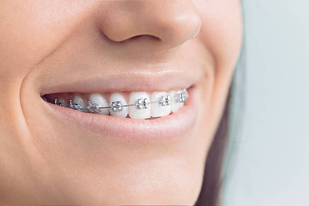 Dental Inlays and Onlays in Buhler, KS